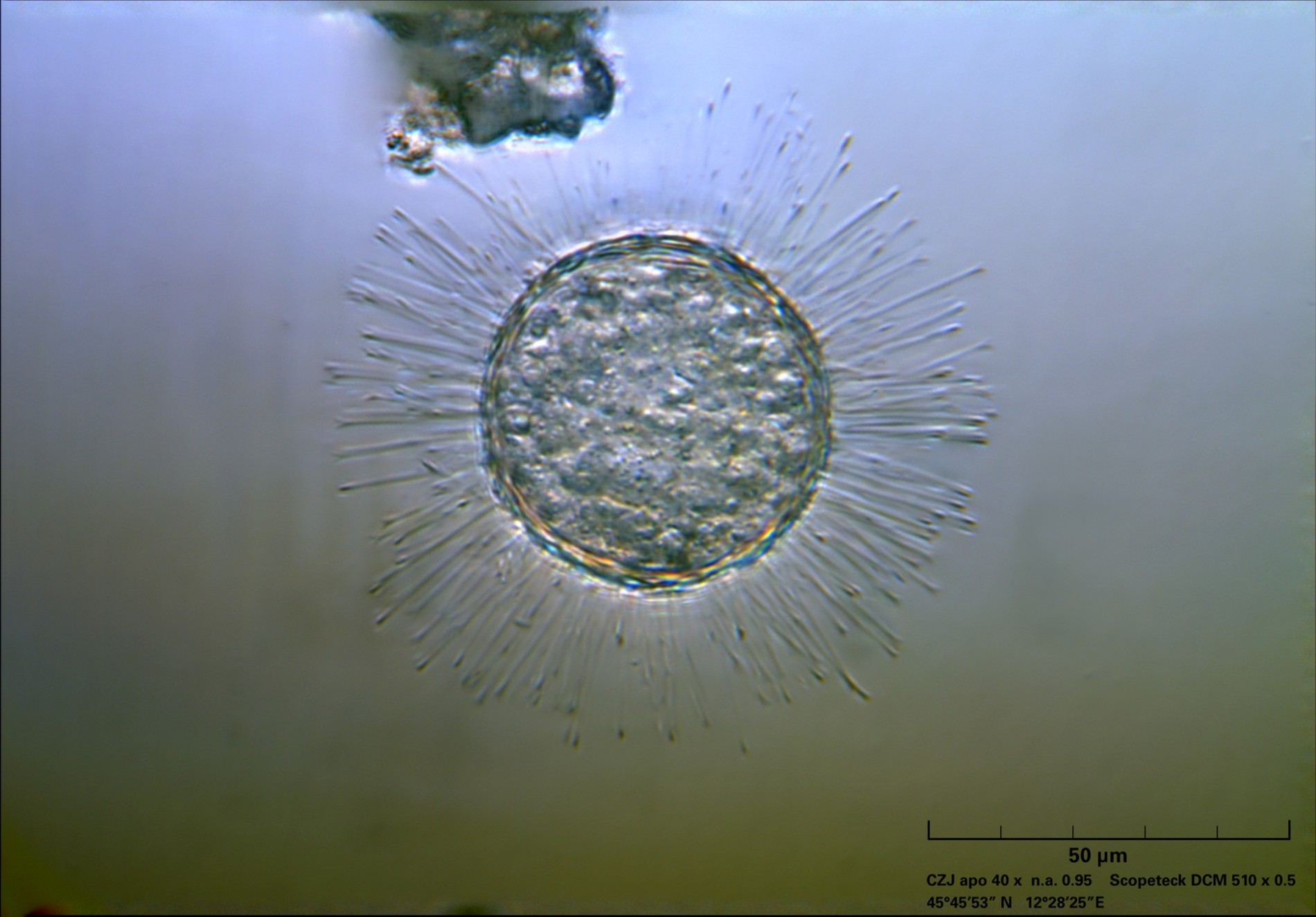 Acanthocystis